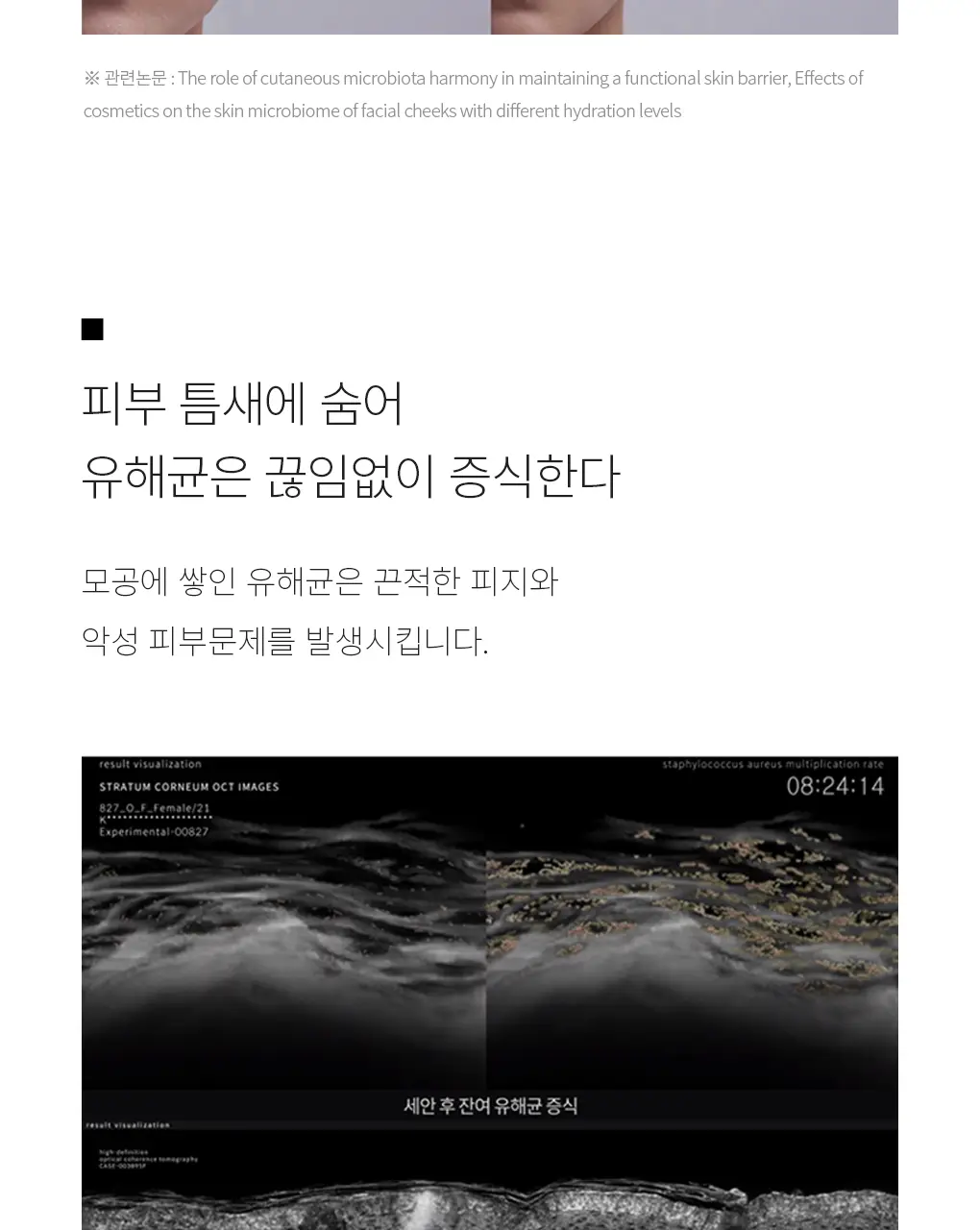 [균제거 클렌저] 디마르3 DX 시타 듀 젤 클렌저 2.0 225g 상세페이지 4
